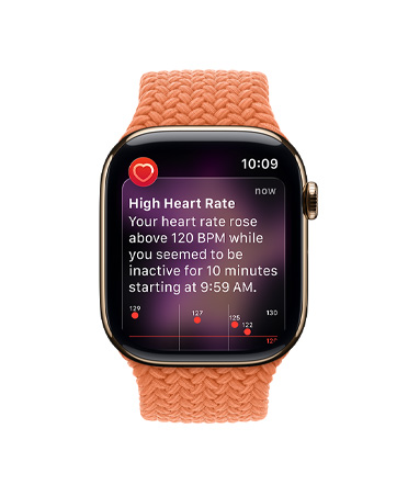 Apple Watch Series 11, zelta krāsas titāna ietvars, pazi?ojums par paātrinātu pulsu, Braided Solo Loop, kurkumas krāsa