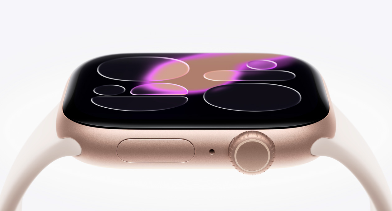 Apple Watch Series 11, zeltrozā krāsa, alumīnija ietvars, Responsive Art ciparnīca, labais sāns, Digital Crown, mikrofons, sānu poga, sporta siksni?a, iesārta krāsa